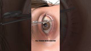 👁️ Created by@plastic.touch Unauthorized use or reposting of this animation is strictlyprohibited❗️
