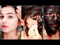 Face whitening Remedy/pigmentation,suntan Removes&  काली हल्दी का जादू/काली हल्दी से चेहरा इतना गोरा