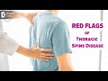 Thoracic back pain RED FLAGS | Thoracic Spine Disease - Dr.Kodlady Surendra Shetty| Doctors' Circle