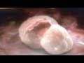 Как происходит имплантация эмбриона