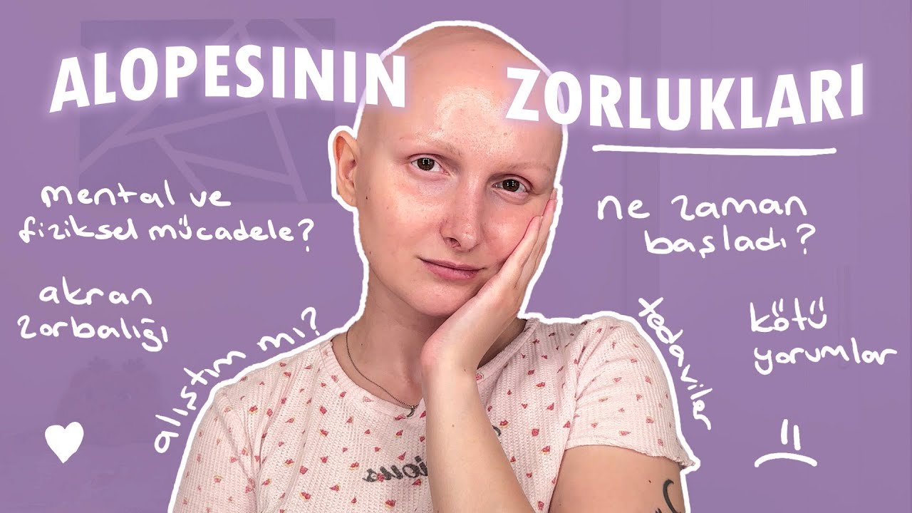 Alopesili Bir Kadının Hayatı