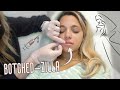 bridal makeover FIXING MY BOTCHED LIPS with threads 🪡 | BRIDAL BOOTCAMP