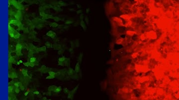 JuLI Stage_Wound healing_movie_(GFP&RFP)_NanoEnTek