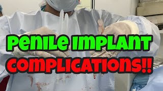 Complications Of Penile Implant Surgery | small penis and unable to do intercourse!!