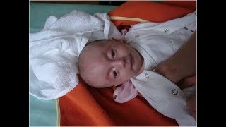 Zespół Edwardsa: przyczyny i o