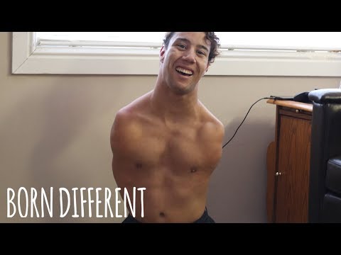 Man Born Without Arms And Legs Lives Life Without Limits | BORN DIFFERENT