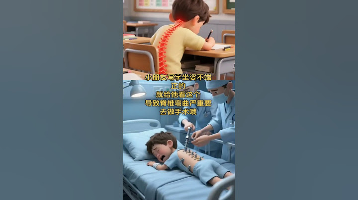 小朋友写字坐姿不端正的，就给他看这个，导致脊椎弯曲严重要去做手术哦#父母必看系列 #亲子教育 #育儿经验分享 #原创视频 #涨知识
