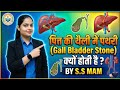 पित्त की थैली में पथरी क्यों बनती है? 😱 लक्षण, कारण और इलाज | BY SS MAM #stone #information #science