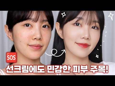 (EVENT) 선크림을 발라도 민감하고 붉어진다면 오세요☀️🆘