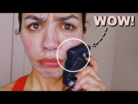 I Used Charcoal Black Soap On My Skin Everyday For One Week