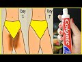 How to Lighten Private Areas Naturally ! 100% Works at home !! Dr Heng Soy