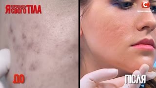 видео Проблемы кожи