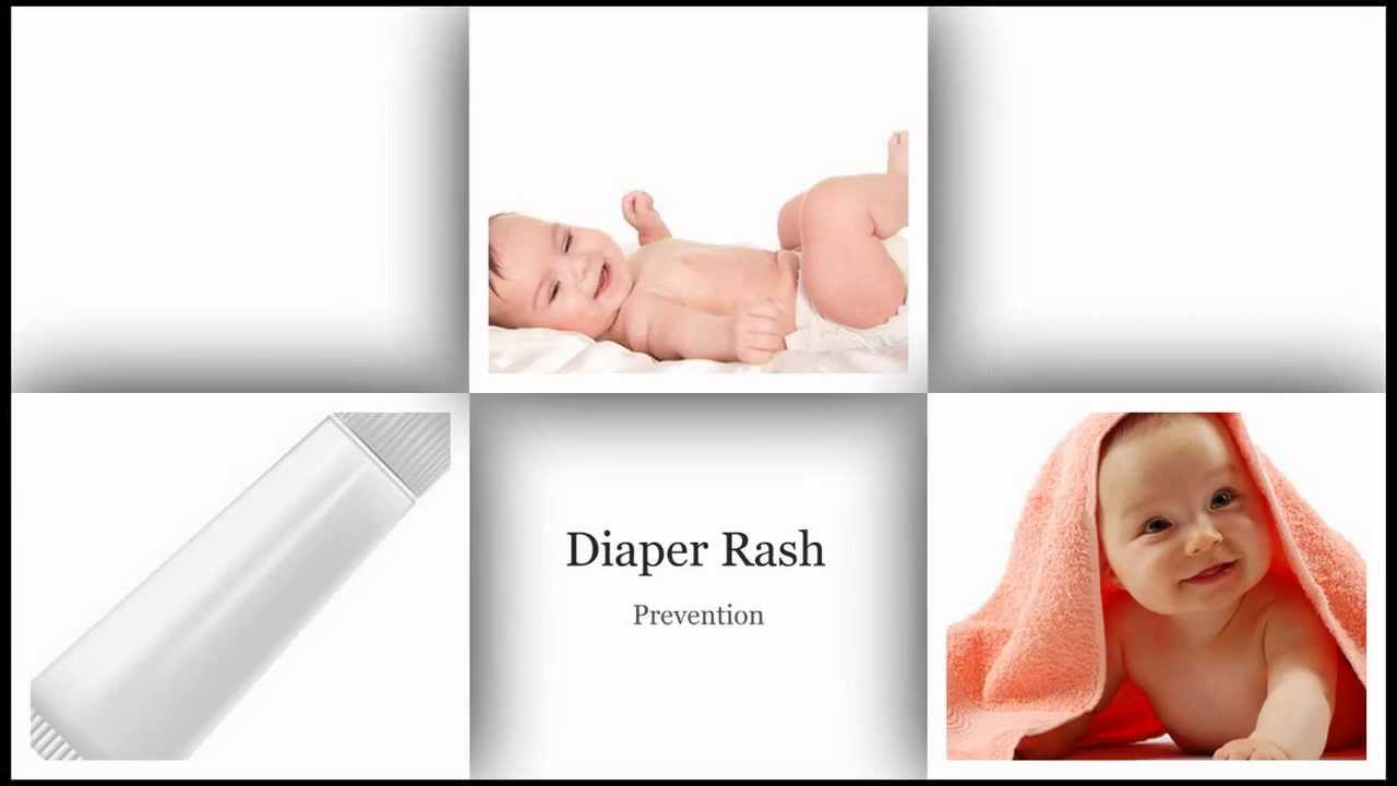 Diaper Rash Prevention
