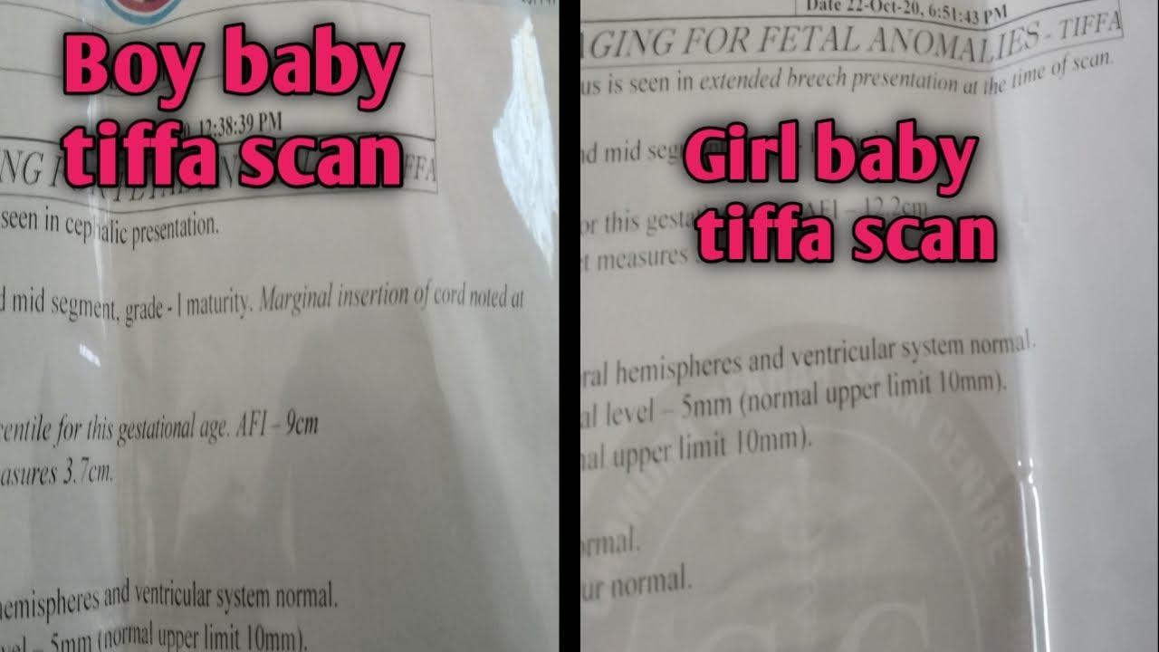 Boy baby and girl baby tiffa scan reports in telugu baby boy scan reports YouTube