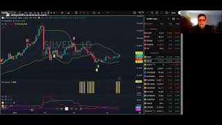 Silver is Coiled to Run