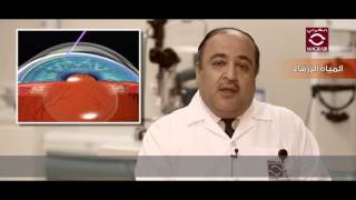 طرق علاج المياه الزرقاء في العين | الدكتور حازم الحمزاوي
