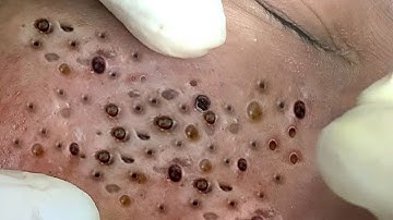 𝐂𝐡𝐢𝐥𝐥 𝐘𝐨𝐮𝐫 𝐋𝐢𝐟𝐞 𝐖𝐢𝐭𝐡 𝐋𝐍𝐆 𝐒𝐤𝐢𝐧 𝐂𝐚𝐫𝐞 # #4691