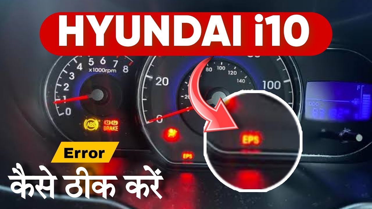 Hyundai i10 EPS error Solution 2026 ✅ Hyundai i10 Kappa EPS problem
