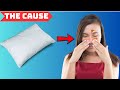 The CAUSE of Your SINUS STUFFINESS Congestion Is HIDING in YOUR PILLOW