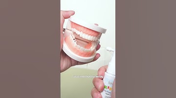 Mẹ tìm mọi cách để chăm sóc răng cho con