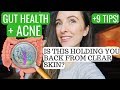 WHY GUT HEALTH IS SO IMPORTANT WITH ACNE + 9 TIPS TO IMPROVE YOUR GUT