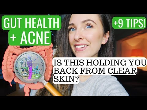 WHY GUT HEALTH IS SO IMPORTANT WITH ACNE + 9 TIPS TO IMPROVE YOUR GUT