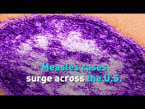 Measles cases surge across the U.S. as outbreaks grow