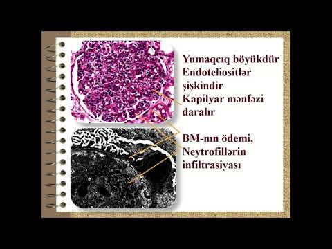 Patoloji anatomiya-2 - Böyrək xəstəlikləri - Mühazirə