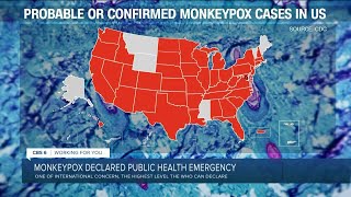 Download Lagu UN health agency chief declares monkeypox a global emergency MP3