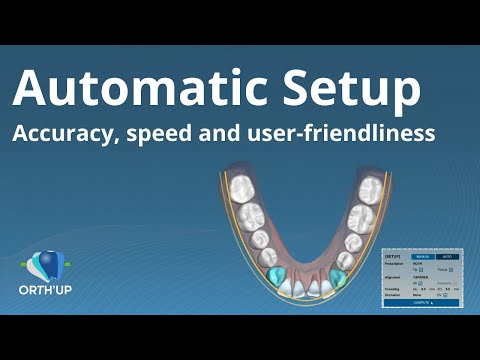 Auto Setup ORTH'UP treatment planning for clear aligners