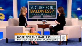 Baldness Cure Close?