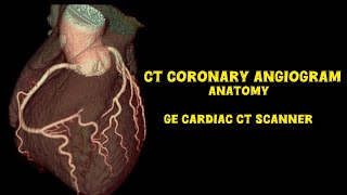 GE CARDIAC CT | CORONARY ANGIOGRAM | RADIOLOGY