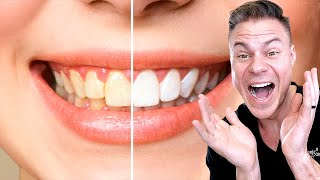 Why Veneers May Be The Right Choice!