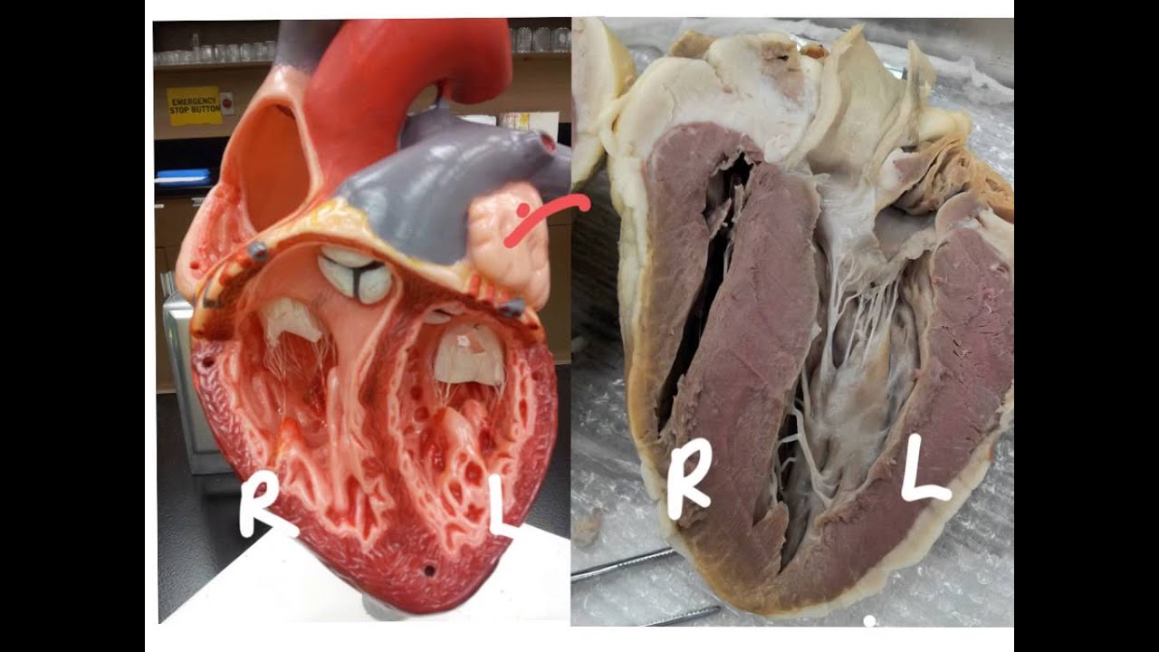 Sheep Heart Dissection - Please note corrections in description. - YouTube