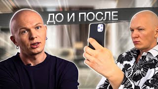 видео: Пластическая хирургия | реалити-шоу Мама, я стилист | 3 Выпуск | Сезон 2 | картинка: Пластическая хирургия | реалити-шоу Мама, я стилист | 3 Выпуск | Сезон 2 |