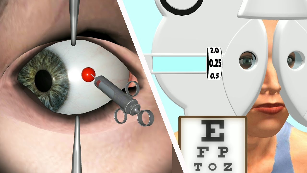 Eye Doctor 👁️🥼👨‍⚕️ | Android Games New Levels | Mobile Game Android ...