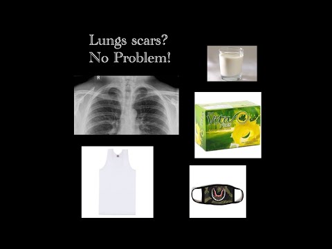 Tips para sa mga may Scar sa lungs!