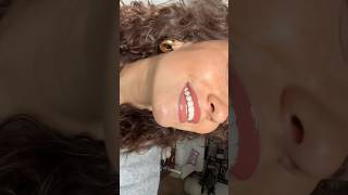 Thought I Needed Lip Filler Till I Tried This