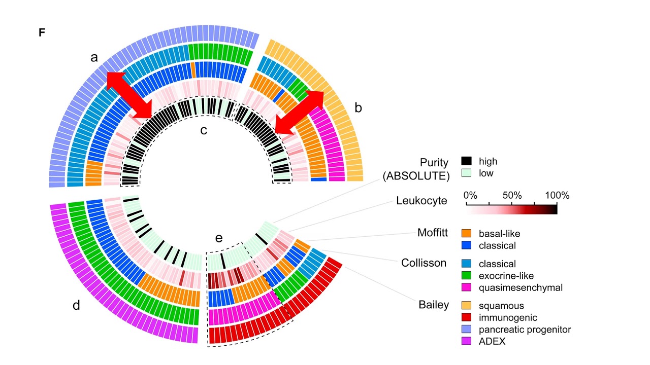 Molecular Subtype of PDAC - YouTube