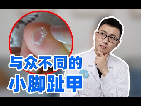 小脚趾甲又厚又丑？裂成两瓣？皮肤科医生告诉你原因