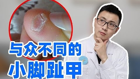 小腳趾甲又厚又丑？裂成兩瓣？皮膚科醫生告訴你原因 - 天天要聞