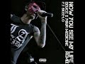 Deuce X Yøur Med!c!ne - Now You See My Life (F.T Skee-Lo) *Extended Version*