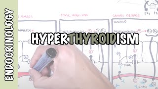 Hyperthyroidism Overview (causes, pathophysiology)