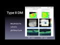 With Years of SLT Data, Why Consider MicroPulse?