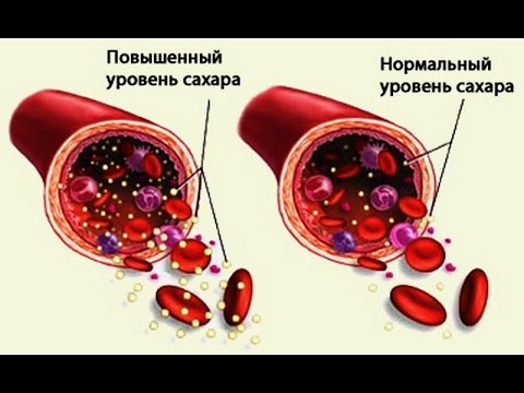 Как нормализовать сахар в крови! Уровень сахара норма| #уровеньсахара #снижатьсахар #edblack Как нормализовать сахар в крови! Уровень сахара норма| #уровеньсахара #снижатьсахар #edblack