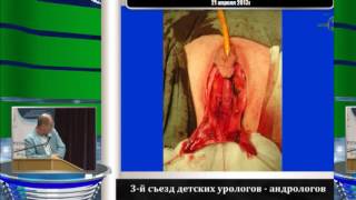 Окулов А Б - Значение пластики входа во влагалище при этапном хирургическом лечении Окулов А Б - Значение пластики входа во влагалище при этапном хирургическом лечении