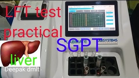 LFT test (liver test) SGPT test practical#lab