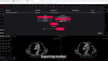 MedDream DICOM Viewer: export the studies