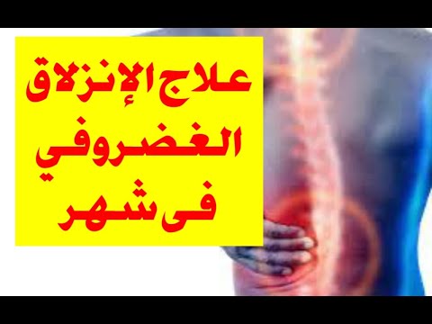 علاج الانزلاق الغضروفى فى شهر بدون ادوية