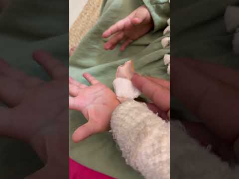 شوشا جرحت يدها يا حرام دعولها ب شفا اكسبلور ترند 
